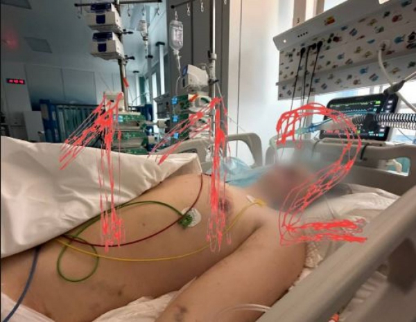 Избивали и мучили воспитатели: над детьми жестоко издевались в России